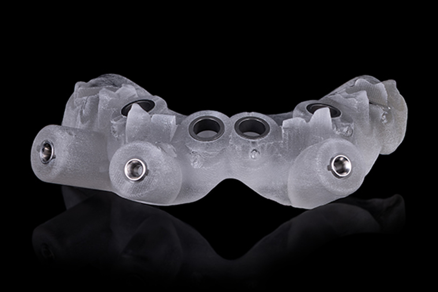 3d printed dental surgical guide seated in mouth directing implant drill placement memphis.
