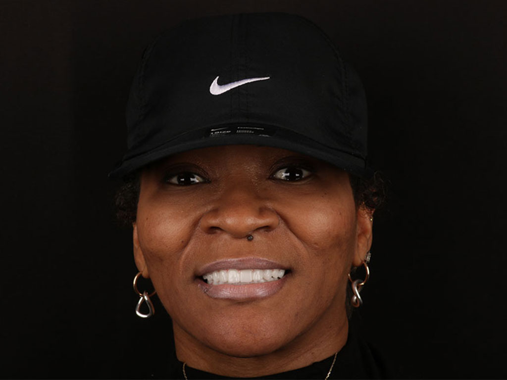 dental implants bartlett tn patient smile after treatment dr adatrow