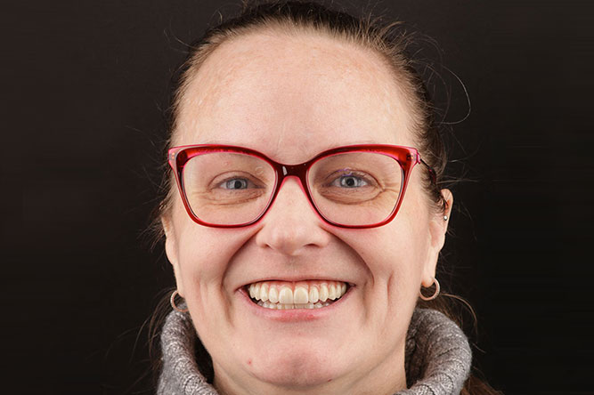 dental implants cordova tn patient smile after treatment dr adatrow