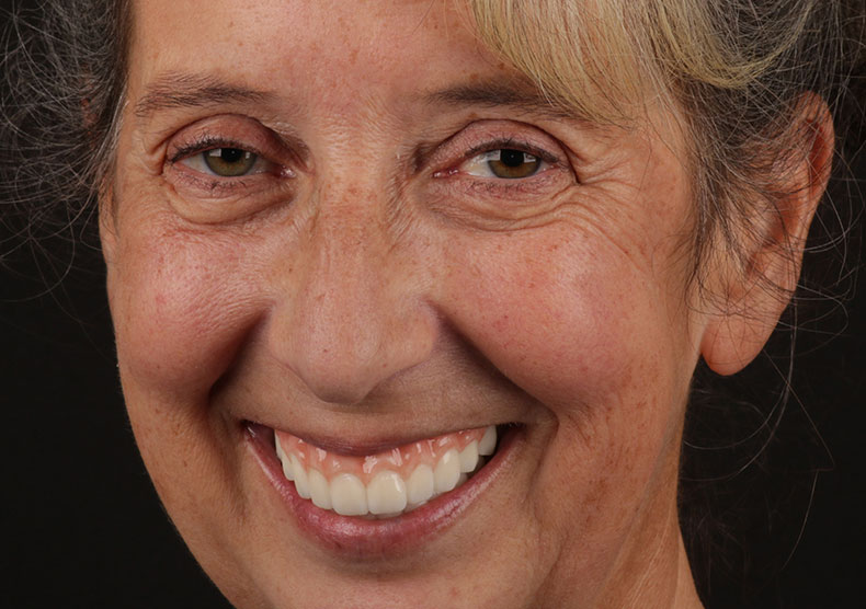 dental implants covington tn patient smile after treatment dr adatrow