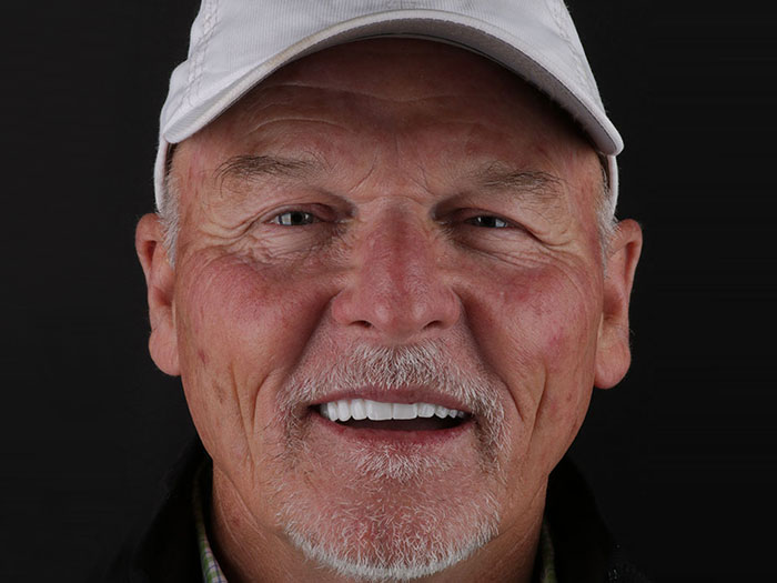 dental implants germantown tn patient smile after treatment dr adatrow