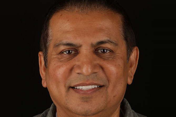 dental implants memphis tn patient smile after treatment dr adatrow