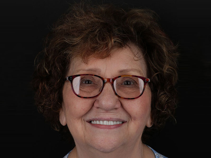 dental implants millington tn patient smile after treatment dr adatrow