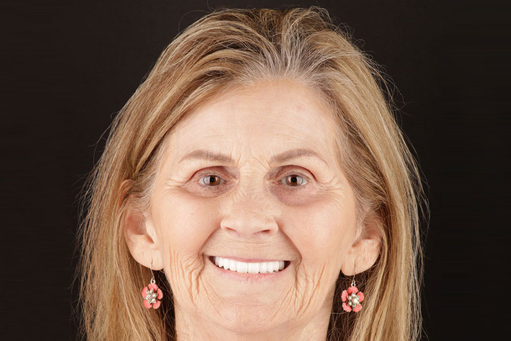 dental implants oakland tn patient smile after treatment dr adatrow