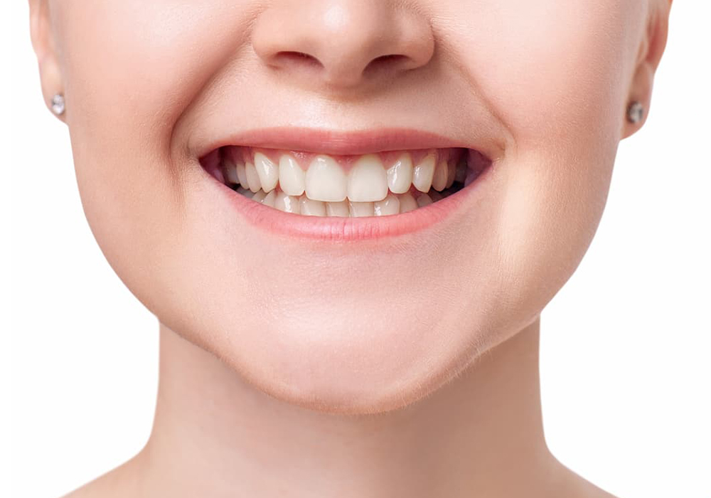 single tooth implant after custom porcelain crown natural match homepage memphis